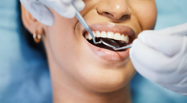 Best Emergency Dental Care for Broken or Chipped Teeth in Mayflower Village, CA
